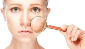 Косметологическое лечение пигментных нарушений кожи