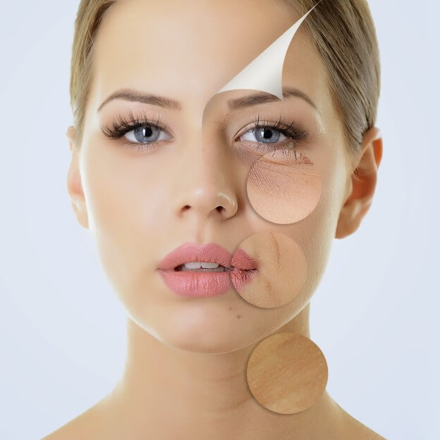Как убрать дряблость кожи лица и тела | Блог Gold Laser