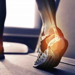 Лечение варикоза Голд лазер