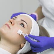 Косметологія обличчя в клинике Gold Laser - изображение 4 Косметологія обличчя в Киеве - изображение 4