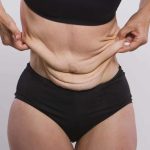 Дряблый живот