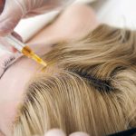 Что лучше для волос: плазмолифтинг или мезотерапия?