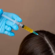 Лечение волос в Киеве - изображение 1