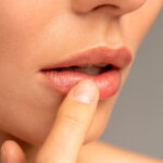 Гранули Фордайса: що це таке і чи потрібно їх лікувати?