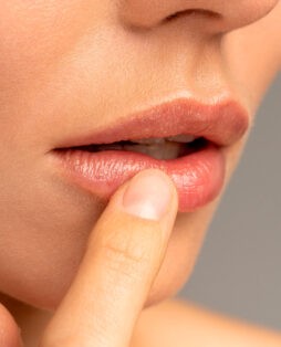 Гранулы Фордайса: что это такое и нужно ли их лечить? в Киеве - изображение 