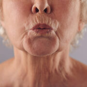 Новини в клинике Gold Laser - изображение 3 Новини в Киеве - изображение 3