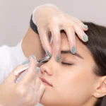 Что нельзя делать после Ботокса: советы врача по уходу и ограничениям